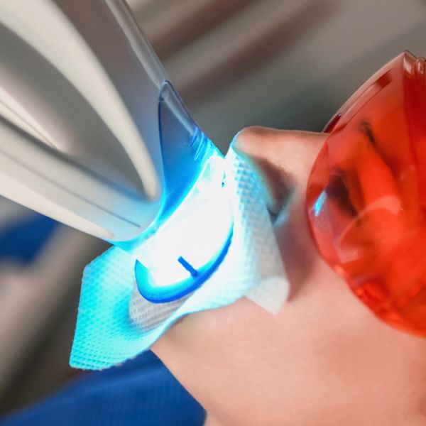 A patient undergoing teeth whitening